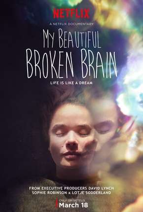 Filme My Beautiful Broken Brain Torrent